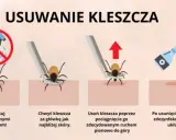 Kleszcz: Wyciągnij, nie wykręcaj! Prawidłowa instrukcja krok po kroku