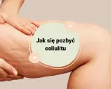 Jak pozbyłam się cellulitu? Mój 4-filarowy plan, który działa!