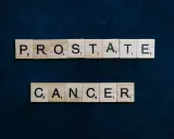 Litery z gry Scrabble układają napis "PROSTATE CANCER". Wiedza o objawach ostatniego stadium raka prostaty jest kluczowa.