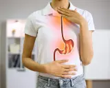 Persona con bruciore di stomaco, illustra la differenza tra pantoprazolo e omeprazolo per alleviare il disturbo.