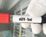 Rękawiczka trzyma probówkę z oznaczeniem "eGFR - Test". To ważny element badania gfr, oceniającego pracę nerek.