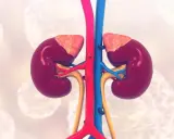 Anatomical illustration of healthy kidneys with blood vessels. Wodonercze to poważny stan, który może dotknąć te narządy.