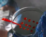 Ricerca medica: gocce rosse su piastra di Petri, parte di un test per capire se hai un tumore.