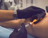 Lekarz w rękawiczkach używa urządzenia do wizualizacji żył i strzykawki. To pokazuje, na czym polega skleroterapia.