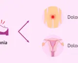Dispareunia: dolor al ser penetrada, ya sea externo o interno.