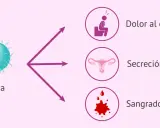 La gonorrea puede causar dolor al orinar, secreción anormal y sangrado vaginal.
