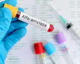 Amylaza podwyższona: co oznacza? Kiedy pilnie do lekarza?