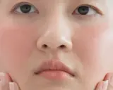 Gros plan sur le visage d'une jeune femme, ses joues rosées évoquant un doux **bouton soleil visage**. Ses mains effleurent délicatement sa peau.