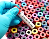 Rękawiczka trzyma probówkę "Cholesterol - Test" na tle wielu kolorowych probówek. Monakolina może wpływać na wyniki, warto to sprawdzić.