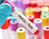 Rękawiczka trzyma probówkę z napisem "HbA1c - Test". W tle kolorowe probówki.