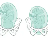 Zwei Babys in Fruchtblasen, bereit für die Geburt. Die Frage ist, wann platzt die Fruchtblase?