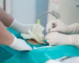 Lekarze w rękawiczkach wykonują amniopunkcję, badanie płynu owodniowego, które odpowiada na pytanie: amniopunkcja co to.
