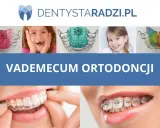 Kto zakłada aparat na zęby? Poznaj rolę ortodonty i proces leczenia