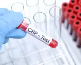 Ręka w niebieskiej rękawiczce trzyma probówkę z napisem "CRP - Test". W tle stoją inne probówki.