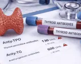 Model tarczycy, probówki z krwią i wyniki badań. Anty-TG są wysokie, co może wskazywać na problemy z tarczycą.