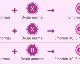 Ilustración de la monosomía X. Muestra cómo un espermatozoide anormal (0) o un óvulo anormal (0) pueden resultar en un embrión X0, conocido como Síndrome de Turner.
