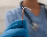 Mano enguantada sostiene un DIU de cobre. Aunque a veces duele ponerse el DIU, es un método anticonceptivo eficaz.