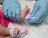 Screening neonatale dopo 15 giorni: un prelievo dal piedino per controlli essenziali.
