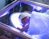 Un neonato dorme sotto luci blu per la fototerapia, con gli occhi protetti da bende.