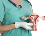 Model macicy z widocznymi mięśniakami. Lekarz w rękawiczkach pokazuje anatomiczny model, ilustrujący problem mięśniaków macicy.