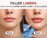 Prima e dopo filler labbra: scopri tecniche, risultati naturali e i rischi, incluse le controindicazioni.