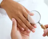 Esame ravvicinato di un'unghia con lente d'ingrandimento, per escludere infezioni come la pseudomonas unghia.