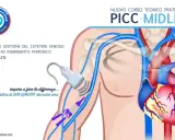 Corso pratico sull'inserimento PICC ecoguidato. Illustrazione anatomica mostra il posizionamento del catetere venoso centrale.
