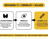 Schemat pokazuje, jak T3 wpływa na fibroblasty, co prowadzi do syntezy kolagenu. Niedoczynność tarczycy spowalnia ten szlak, zmniejszając ilość kolagenu.