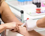 Pobieranie krwi do badań. To standardowa procedura, która pozwala ocenić stan zdrowia.