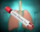 Provette con campione di sangue per il test della fibrosi cistica, con polmoni stilizzati sullo sfondo.