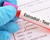 Ręka w niebieskiej rękawiczce trzyma probówkę z napisem "Estradiol - Test". Obok widoczny formularz z zaznaczonym polem ESTRADIOL, sugerującym wysoki estradiol.