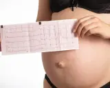 Pancia di donna incinta con elettrocardiogramma che mostra tachicardia. Monitoraggio cardiaco in gravidanza.