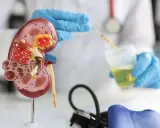 Model nerki i test paskowy do analizy moczu, kluczowe elementy w diagnostyce i leczeniu nerkozastępczym.