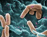 Immagine al microscopio elettronico di Pseudomonas aeruginosa, un batterio contagioso che si presenta come bastoncini marroni su uno sfondo bluastro.