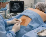 Lekarz wykonuje nakłucie torbieli na nerce pod kontrolą USG. Pacjent leży na brzuchu, a lekarz w rękawiczkach i masce przygotowuje się do zabiegu.