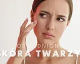 Kobieta zmartwiona stanem swojej odwodnionej skóry twarzy, dotyka policzka.