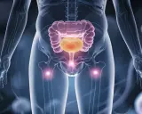 Anatomia człowieka z widocznym jelitem grubym i pęcherzem. Może to symbolizować ucisk na pęcherz.