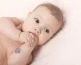 Bebé con un angioma en el brazo, mirando a la cámara con curiosidad.