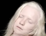 Portret albinosa z blond włosami i zamkniętymi oczami na czarnym tle.