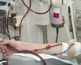 Dializa nerek jak długo można żyć? Pacjent podłączony do aparatury medycznej, krew krąży przez przewody.