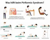 Illustrationen zeigen Übungen zur Linderung des Piriformis-Syndroms, wie Dehnung der Gesäßmuskulatur, Physiotherapie und Schwimmen.
