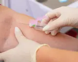 Pobieranie krwi do badania, które może wykazać, czy limfocyty podwyższone u dorosłego wymagają dalszej diagnostyki.