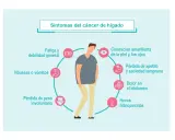 ¿Cáncer de hígado? Conoce sus síntomas y actúa a tiempo