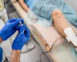 Lekarz przygotowuje się do zabiegu ablacji serca. Ile trwa zabieg? To zależy od złożoności.