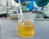 Testy paskowe zanurzone w próbce moczu, wskazujące na badanie pęcherza moczowego.