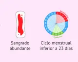 Ilustraciones sobre sangrado premenstrual: duración >8 días, sangrado abundante, ciclo corto (<23 días) y metrorragia.