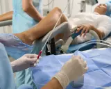 Person w rękawiczkach przygotowuje się do procedury, która może pomóc w oddawaniu moczu po wyjęciu cewnika. Pacjentka leży na fotelu ginekologicznym.