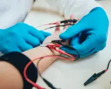 Badanie EMG, czyli elektromiografia, to badanie oceniające funkcję nerwów i mięśni. Na zdjęciu widać elektrody podłączone do ręki pacjenta.