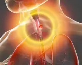 Cáncer de esófago: síntomas clave que no debes ignorar. ¿Los conoces?