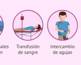 Ilustraciones muestran cómo se puede dar el contagio de clamidia: relaciones sexuales sin protección, transfusión de sangre, intercambio de agujas y embarazo.